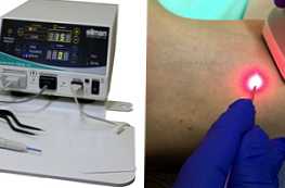 Čo je lepšie zvoliť chirurgické alebo laserové porovnávacie zariadenia