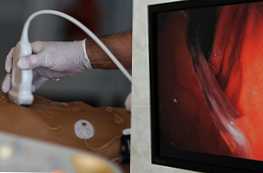 Kateri postopek je boljši od ultrazvoka želodca ali FGDS?