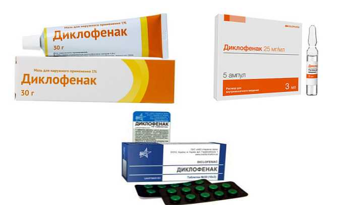 diklofenak svijeće za bolove u zglobovima)
