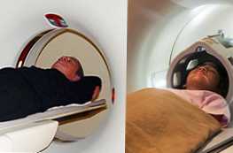 CT nebo MRI metod porovnávání mozku a která je lepší