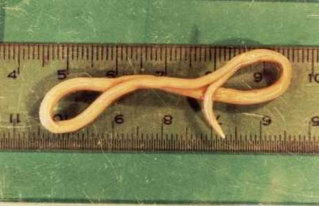 Razlika med okrogli črvi in ​​pinworms