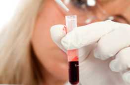 V čem se splošni krvni test razlikuje od kliničnega