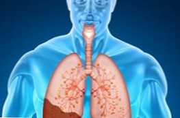 V čem se pljučnica razlikuje od pljučnice?