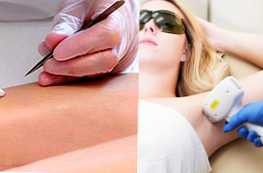 Apa yang lebih baik elektrolisis atau perbandingan dan fitur hair removal laser