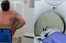 Što je bolji rendgen pluća ili CT i kako se oni razlikuju?