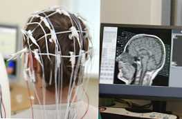 ЕЕГ и ЯМР на мозъчното сравнение на методите и кое е по-добро