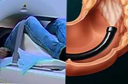 MRI usus dan kolonoskopi bagaimana mereka berbeda dan mana yang lebih baik