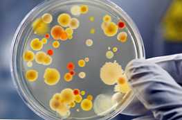 По какво се различават бактериите от протозоите