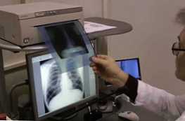 У чому різниця між рентгеном і флюорографией